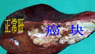 水污染与癌症高发区必备这款仪器